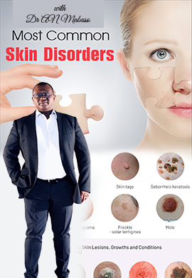 Common skin conditions
